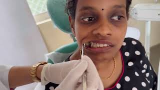 Appliance Delivery Occlusal Interference MALAYALAM [upl. by Riess58]