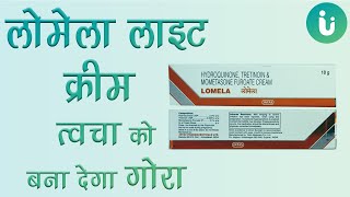 Lomela lite Cream के फायदे नुकसान  Lomela lite Cream lagane ka sahi tarika uses review in hindi [upl. by Lukin]