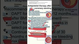 Antiplatelet therapy after coronary stenting [upl. by Oirasor]