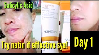 Day 1 Salicylic Acid effective ba [upl. by Lachance]