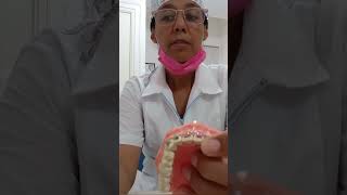 Cepillado de dientes con brackets explicación sencilla y práctica [upl. by Otes]