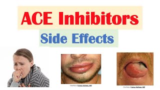 ACE Inhibitor Side Effects Lisinopril Ramipril Captopril Perindopril  Causes and Why They Occur [upl. by Ushijima767]