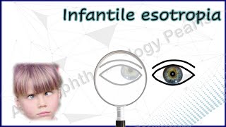 Infantile Esotropia Simplified 1│Understanding Various Phenomena amp Differential Diagnosis [upl. by Ydnagrub]