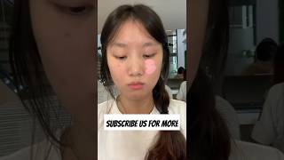 Hiding Face Discoloration Quick Tips for blemished skin  Skincare Beautytips Shorts [upl. by Alioz]