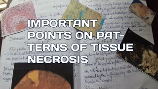 Important points on Patterns of tissue necrosisCell injuryCell deathPathology [upl. by Tterej]