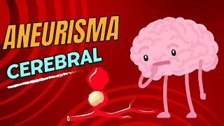 Aneurisma cerebral [upl. by Medora400]