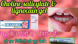 Mouth Ulcer gel choline sacilylate amp lignocain hcl gel use dosage precaution in hindi [upl. by Niels]