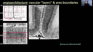 OHBM 2022  Keynote  Jon Polimeni  How far can we go with functional MRI What the blood vessels… [upl. by Hendren324]