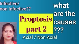 Classification and causes of Proptosis  Axial or non axial proptosis [upl. by Sudnor]