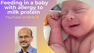 Approach to feeding in baby with milk protein allergy Dr Sridhar K [upl. by Litch]