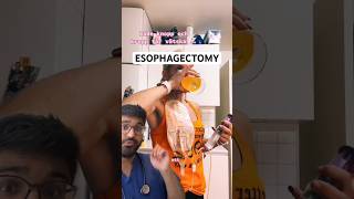 DOCTOR REACTS to ESOPHAGECTOMY and ESOPHAGOSTOMY [upl. by Wilterdink]