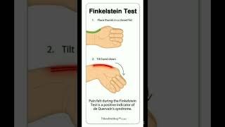 Finkelstein test viralshort allaboutnorcet medicaleducation biology nursingofficer [upl. by Potash]