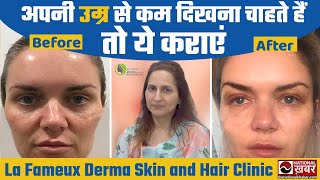 Thread lifting से दिख सकते हैं अपनी उम्र से कम। Dr Chanchal Chowdhury। Lafmex darma clinic [upl. by Chavaree]