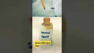 Urine Bilirubin test  Urine Examination  Urine Test urine mbbs haematology medical shorts [upl. by Ardnoed]