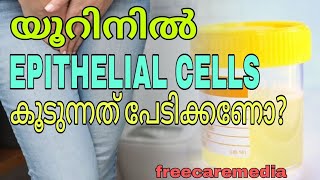 Urine test malayalam epithelial cells in urineurinetest urineinfection urine [upl. by Aieki753]