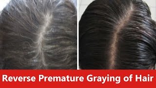 How to Reverse Premature Graying of Hair Naturally [upl. by Trixie]