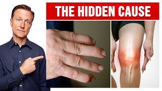 The Hidden Cause of Arthritis in Your Knees and Hands [upl. by Broek]