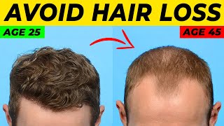 Topical Finasteride For Hair Loss What YOU Need To Know [upl. by Ramad]