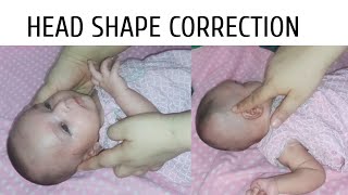 Baby Head Shape Correction  Flat Head Syndrome  Flat Head Prevention [upl. by Ennaid397]