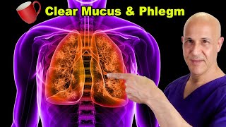 How to get rid of mucus in the throat and phlegm [upl. by Adnilasor]