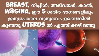 5 Early Pregnancy Symptoms Deechus world Malayalam [upl. by Wachtel]