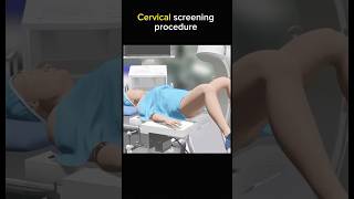 Cervical screening procedure cervix female womenissues [upl. by Browne335]