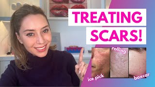 How To Treat Scars Flat Depressed Raised and Keloids  Dr Shereene Idriss [upl. by Ripp834]