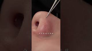 she came to quotcomfortquot her skin immersiveskincare blackheads asmr skinmanagement facialspa [upl. by Avram]