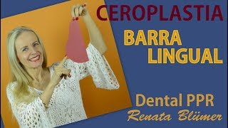 CEROPLASTIA BARRA LINGUAL  PPR [upl. by Chladek]