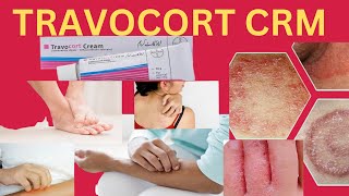 Travocort cream  How to use travocort cream  Fungal infection travocort cream [upl. by Reena]