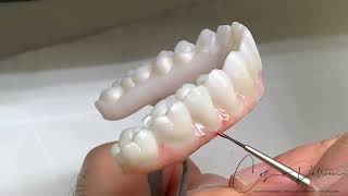 Implant Bridges Zirconia Monolithic Double Full Arch Tutorial [upl. by Ennaylloh]