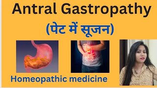 Antral Gastropathy पेट में सूजन treatment  Antral gastritis symptomscause amp homeopathic medicine [upl. by Ymar]