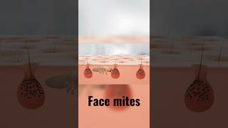 Mites on your face incredibly benefiting you  Human demodex Mites [upl. by Toblat]