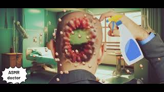 ASMR doctor animiton treatment form head infected the whole of head2D Animiton asmrdoctor [upl. by Danete]