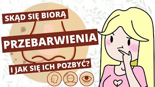 Rozjaśnianie przebarwień i blizn po trądziku  porady i kosmetyki [upl. by Necyrb398]