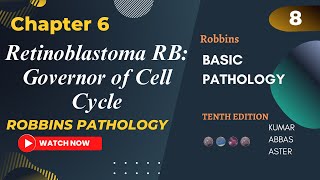 Retinoblastoma RB Governor of Cell Cycle  RB Pathway Neoplasia Lecture 8 Robbins Patho Chapter 6 [upl. by Ylrad]