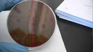 BIO 2192 UNIT 11  Strep Hemolysis Reactions on Blood Agar [upl. by Appilihp720]