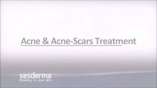 Mediderma Acne amp Acne Scar Treatment On ClickOnCare [upl. by Eudora]