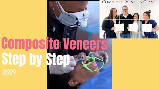 Composite Veneers Tutorial [upl. by Sherourd]