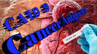 CA 199 a Tumor marker for pancreatic cancer [upl. by Charin]