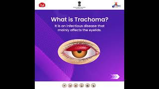 Trachoma [upl. by Piotr]