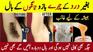 Remove Unwanted Facial Hair At Home  Permanent Hair Removal Home Remedy  Painless Hair Removal [upl. by Tail]