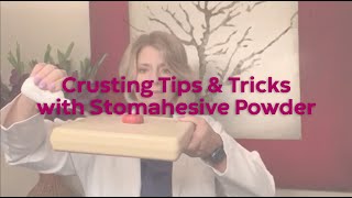 Crusting Tips and Tricks with Stomahesive Powder [upl. by Aihsenal372]