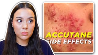 My 12 MONTHS Accutane SIDE EFFECT Timeline [upl. by Ettenuahs]