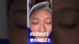 Reduce the Appearance of Wrinkles in 1 Easy Treatment [upl. by Naenej]