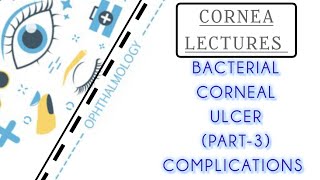 CORNEA LECTURE 5 COMPLICATIONS OF CORNEAL ULCER [upl. by Boorman]