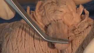 Cranial Nerves Neuroanatomy Video Lab  Brain Dissections [upl. by Pinchas]