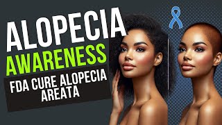 The FDA APPROVED Solution to Alopecia Areata Treatment [upl. by Jamie]