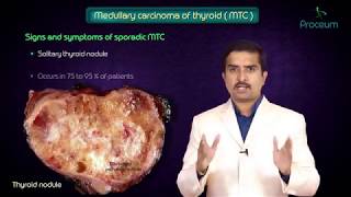 Thyroid neoplasms part 3  Medullary carcinoma of thyroid   Endocrine pathology [upl. by Cathrine597]