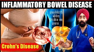 DIET for IBD  Crohns Disease का मेडिकल कारन और इलाज  Explained in HIndi by DrEducation [upl. by Kayley]